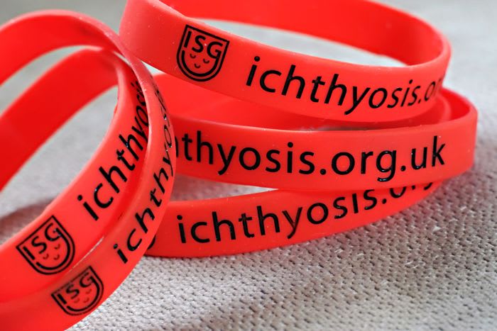 Wristbands